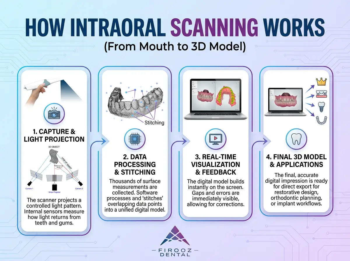 intraoral scanner how it works