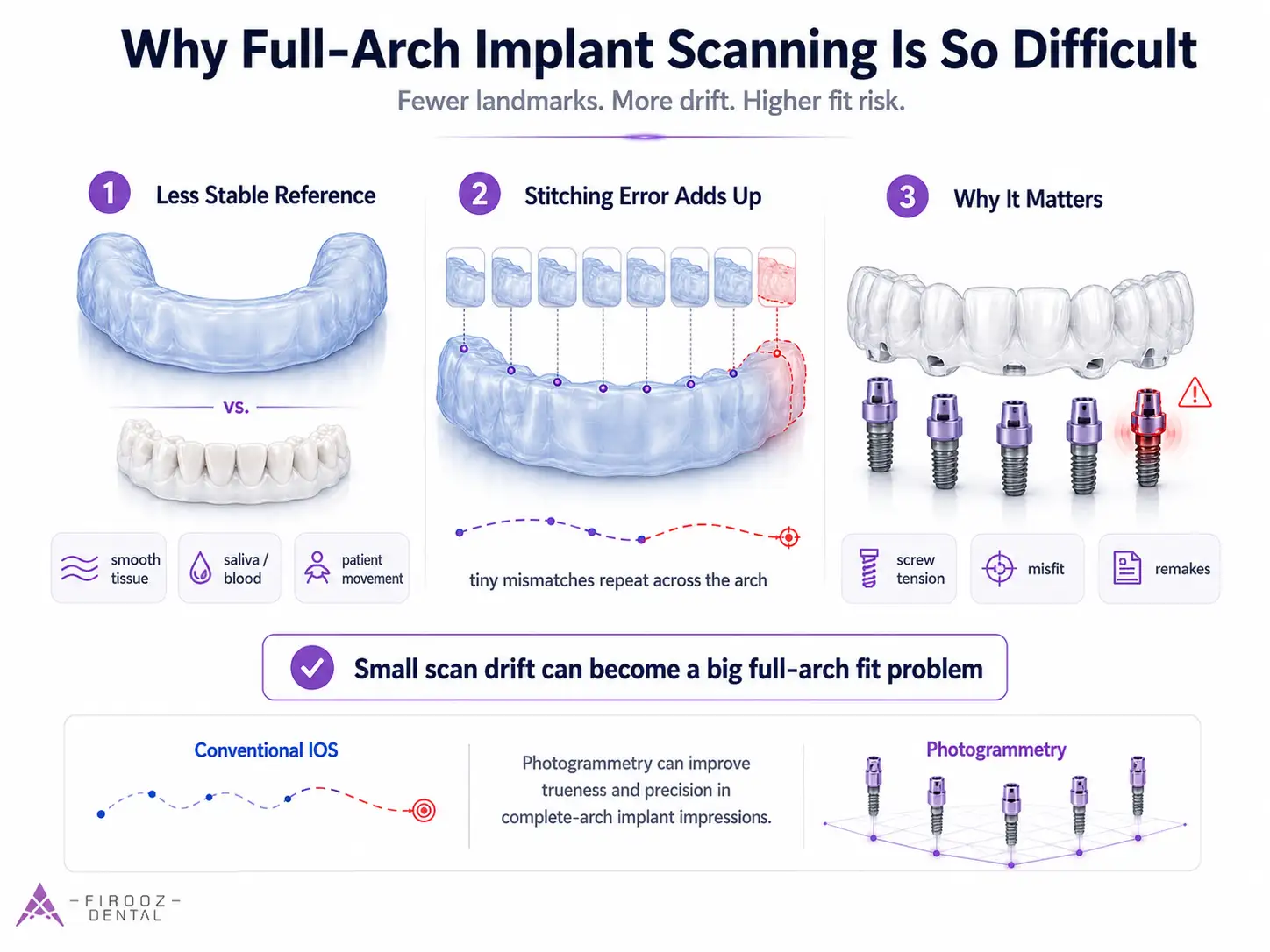 Why Full-Arch Implant Scanning Is So Difficult