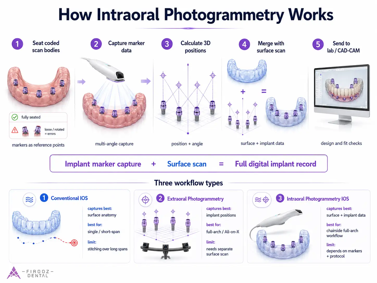 How Intraoral Photogrammetry Works