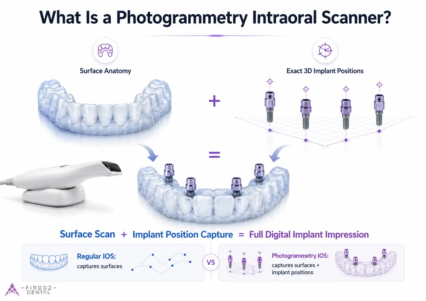 What Is a Photogrammetry Intraoral Scanner?