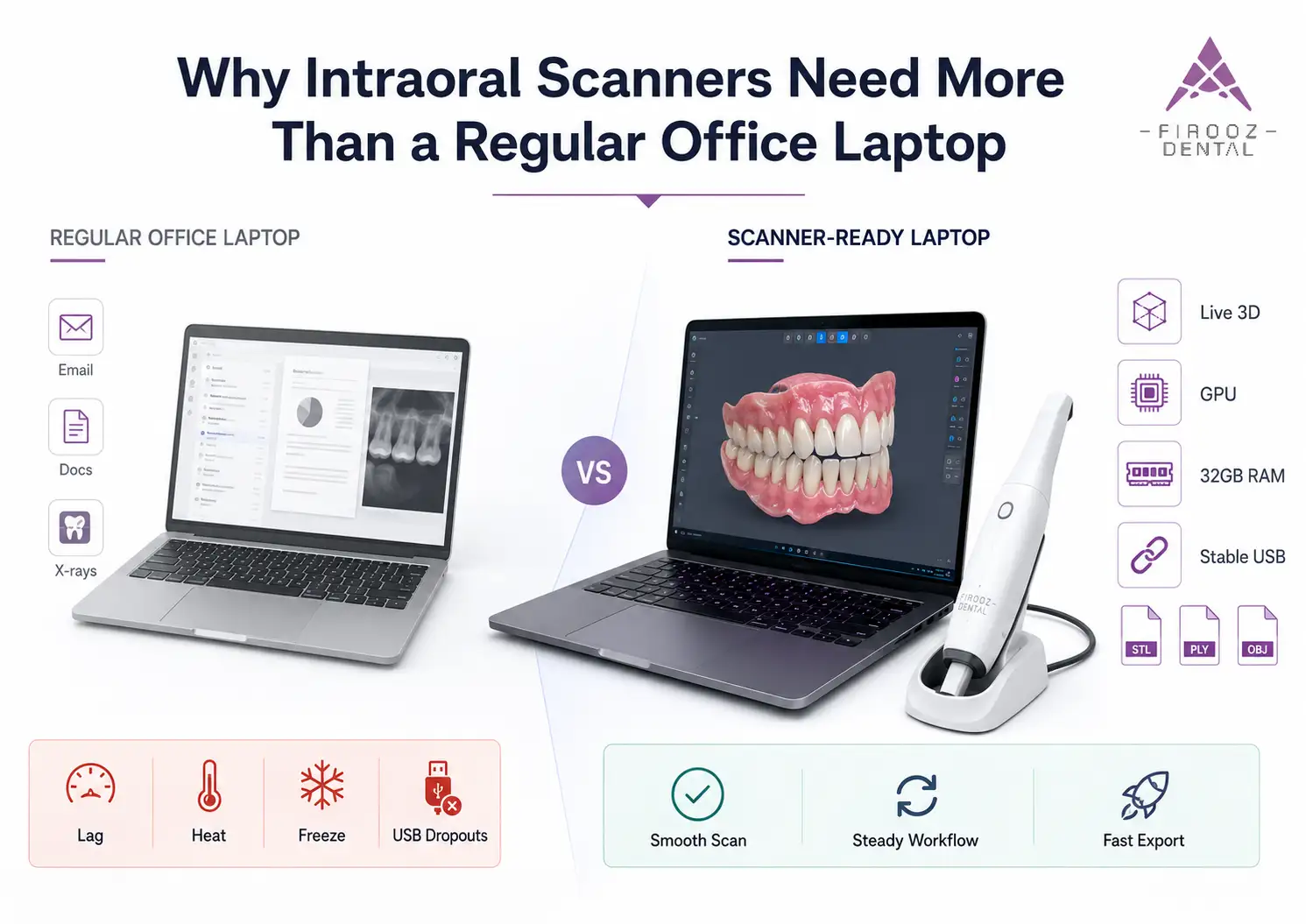 laptop for intraoral scanner